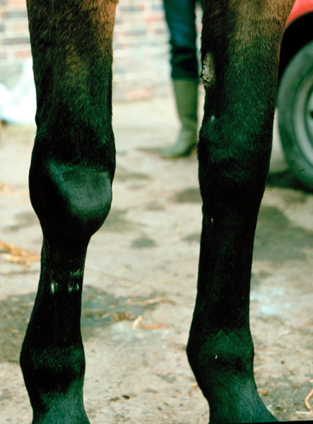 carpal hygroma
