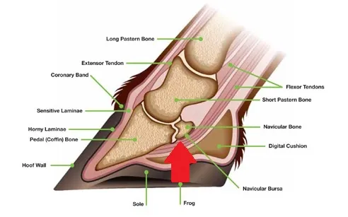 navicular syndrome
